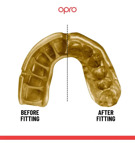 Opro GOLD series GEN5 Prostateftiki masela ENILIKON -clear